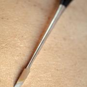 Outils de dentiste